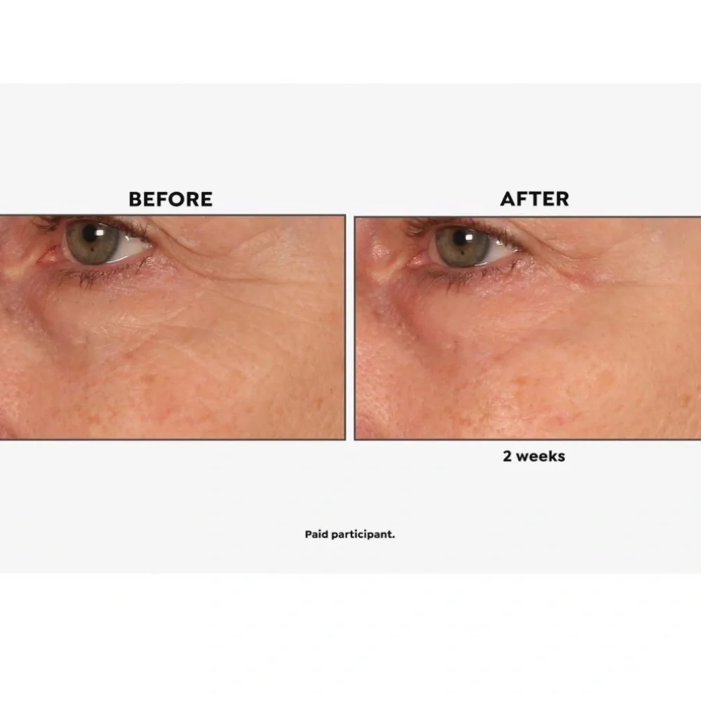 Perlier eye serum